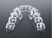 Omega Loop